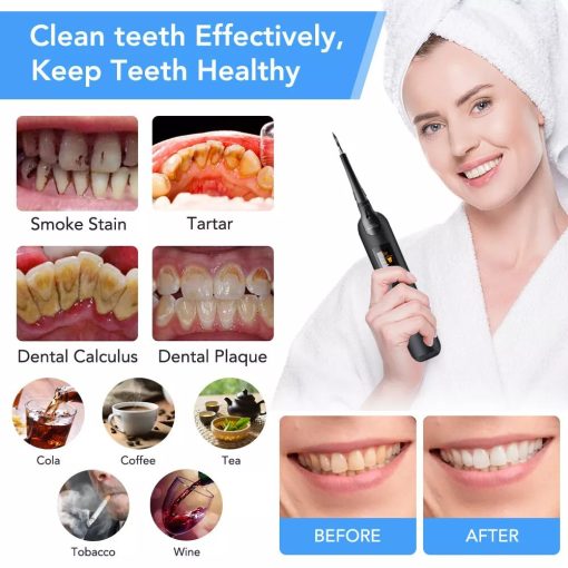 Electric Dental Calculus Remover